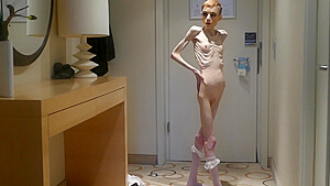 Anorexia Christin showing her Bones & Skinny Skeleton HD Casting